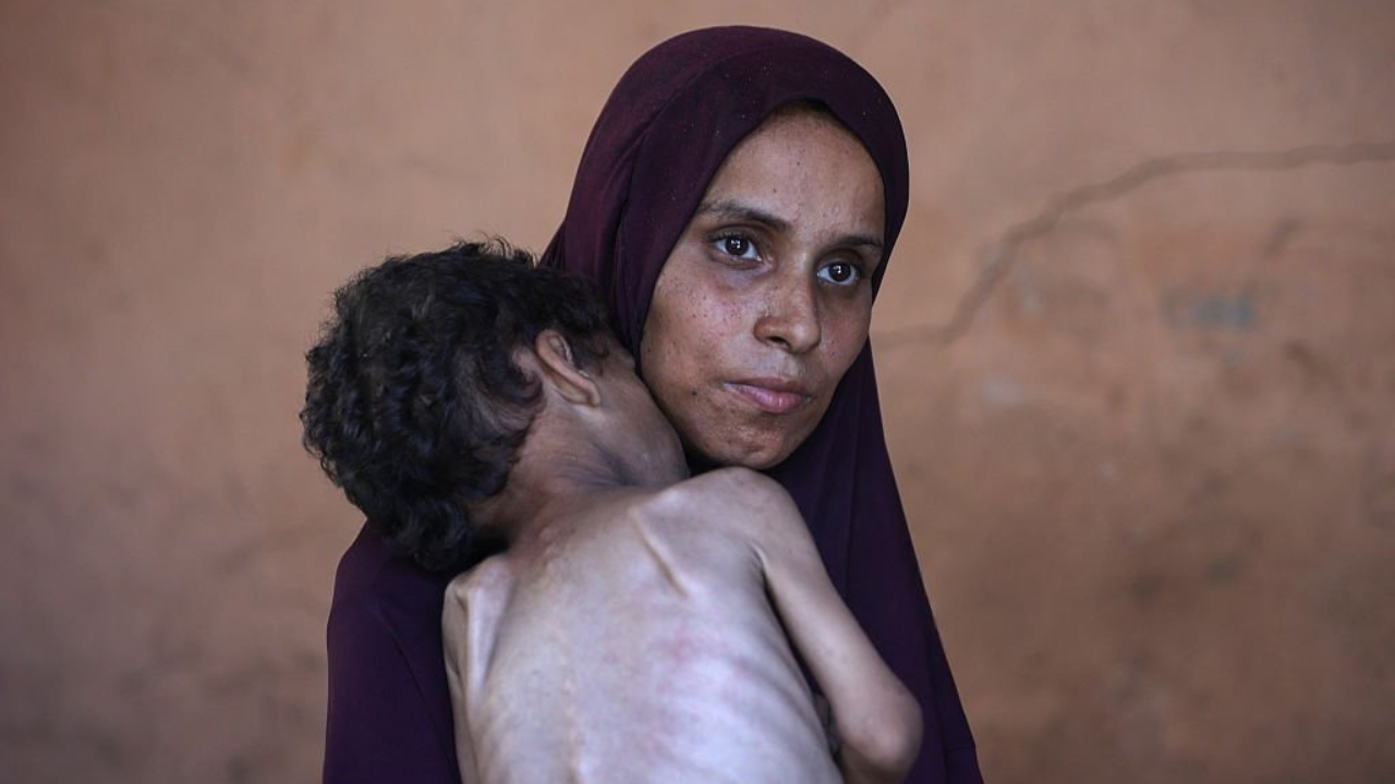 গাজায় ক্ষুধায় ১১৩ ফিলিস্তিনির মৃত্যু