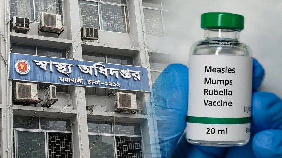 ২৪ ঘণ্টায় হাম উপসর্গে ৪ জনের মৃত্যু