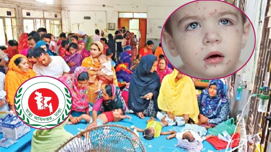 ২৪ ঘণ্টায় হামে ৪ জনের মৃত্যু, শনাক্ত ১১৫
