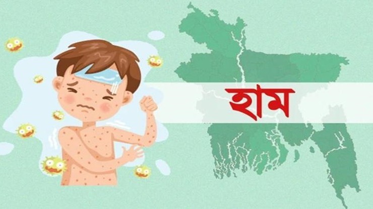 হামের উপসর্গে আরও ২ শিশুর মৃত্যু, মোট প্রাণহানি ৮৪৯